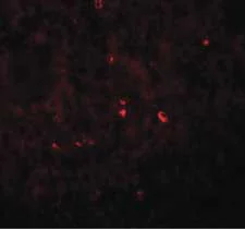 Immunocytochemistry/ Immunofluorescence - Anti-Angiogenin antibody (AB189207)