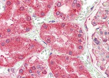 Immunohistochemistry (Formalin/PFA-fixed paraffin-embedded sections) - Anti-Angiogenin antibody (AB189207)