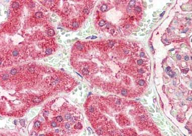 Immunohistochemistry (Formalin/PFA-fixed paraffin-embedded sections) - Anti-Angiogenin antibody (AB189207)