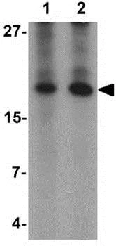 Western blot - Anti-Angiogenin antibody (AB189207)