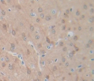 Immunohistochemistry (Formalin/PFA-fixed paraffin-embedded sections) - Anti-Angiogenin antibody (AB231028)