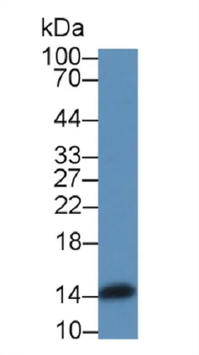 Western blot - Anti-Angiogenin antibody (AB231028)