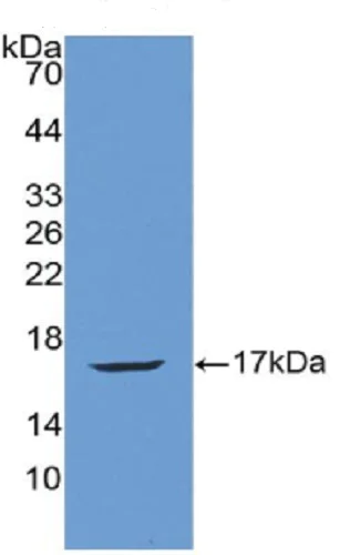 Western blot - Anti-Angiogenin antibody (AB231028)
