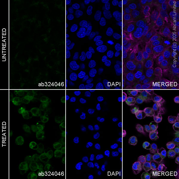 Immunocytochemistry/ Immunofluorescence - Anti-Angiogenin antibody [EPR29570-513] (AB324046), expandable thumbnail