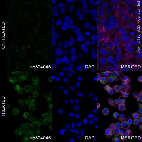 Immunocytochemistry/ Immunofluorescence - Anti-Angiogenin antibody [EPR29570-513] (AB324046)