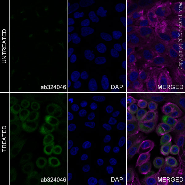 Immunocytochemistry/ Immunofluorescence - Anti-Angiogenin antibody [EPR29570-513] (AB324046), expandable thumbnail