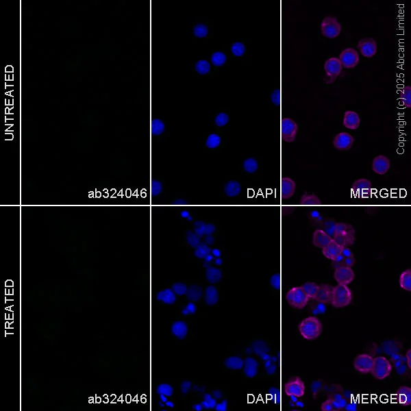 Immunocytochemistry/ Immunofluorescence - Anti-Angiogenin antibody [EPR29570-513] (AB324046)