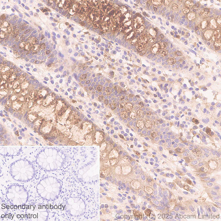 Immunohistochemistry (Formalin/PFA-fixed paraffin-embedded sections) - Anti-Angiogenin antibody [EPR29570-541] (AB324526)