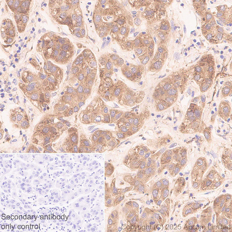 Immunohistochemistry (Formalin/PFA-fixed paraffin-embedded sections) - Anti-Angiogenin antibody [EPR29570-541] (AB324526)
