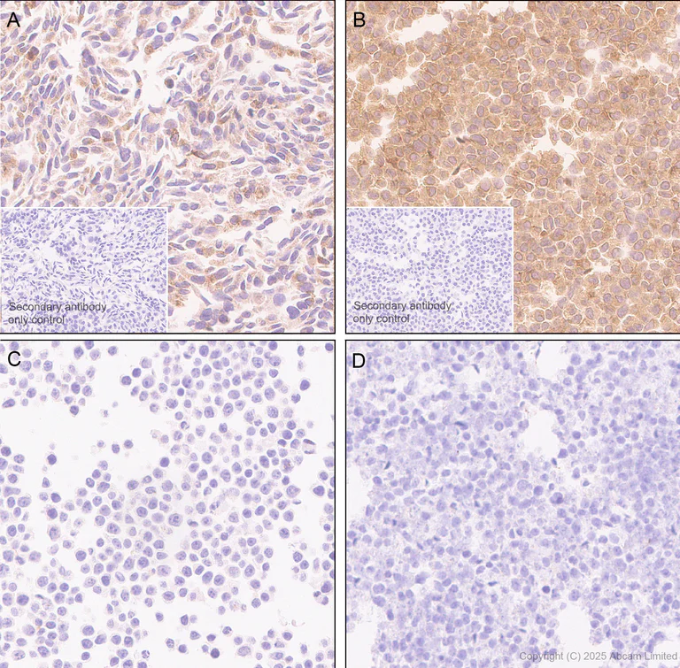Immunohistochemistry (Formalin/PFA-fixed paraffin-embedded sections) - Anti-Angiogenin antibody [EPR29570-541] (AB324526)