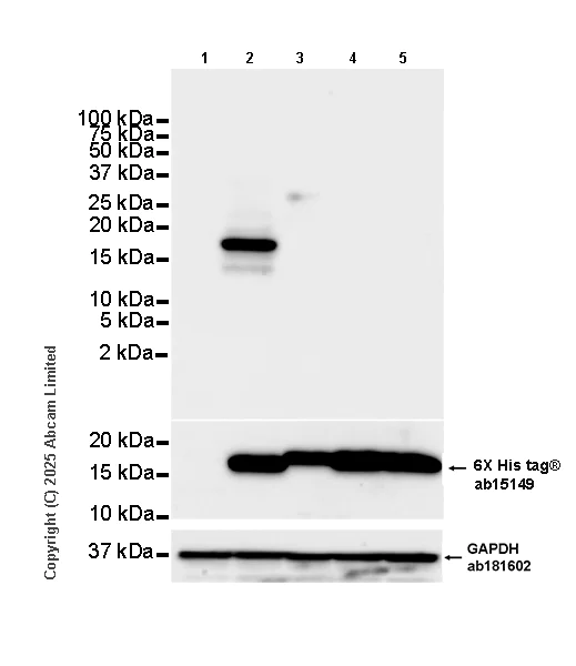 Western blot - Anti-Angiogenin antibody [EPR29570-541] (AB324526)