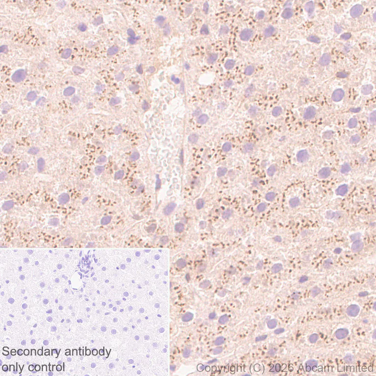 Immunohistochemistry (Formalin/PFA-fixed paraffin-embedded sections) - Anti-Angiogenin antibody [EPR29571-709] (AB326337)