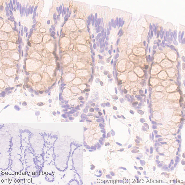 Immunohistochemistry (Formalin/PFA-fixed paraffin-embedded sections) - Anti-Angiogenin antibody [EPR29571-709] (AB326337)