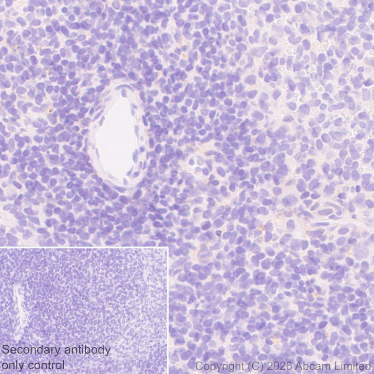 Immunohistochemistry (Formalin/PFA-fixed paraffin-embedded sections) - Anti-Angiogenin antibody [EPR29571-709] (AB326337)