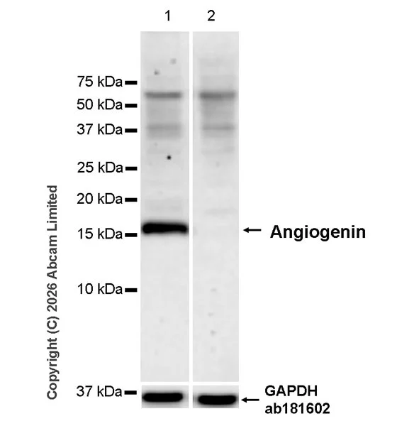 Western blot - Anti-Angiogenin antibody [EPR29571-709] (AB326337)