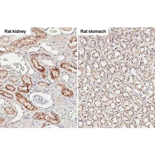Immunohistochemistry (Formalin/PFA-fixed paraffin-embedded sections) - Anti-Angiogenin antibody [HL2215] (AB317165)