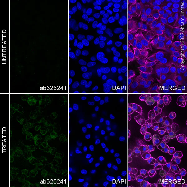 Immunocytochemistry/ Immunofluorescence - Anti-Angiogenin antibody [RM2092] (AB325241)