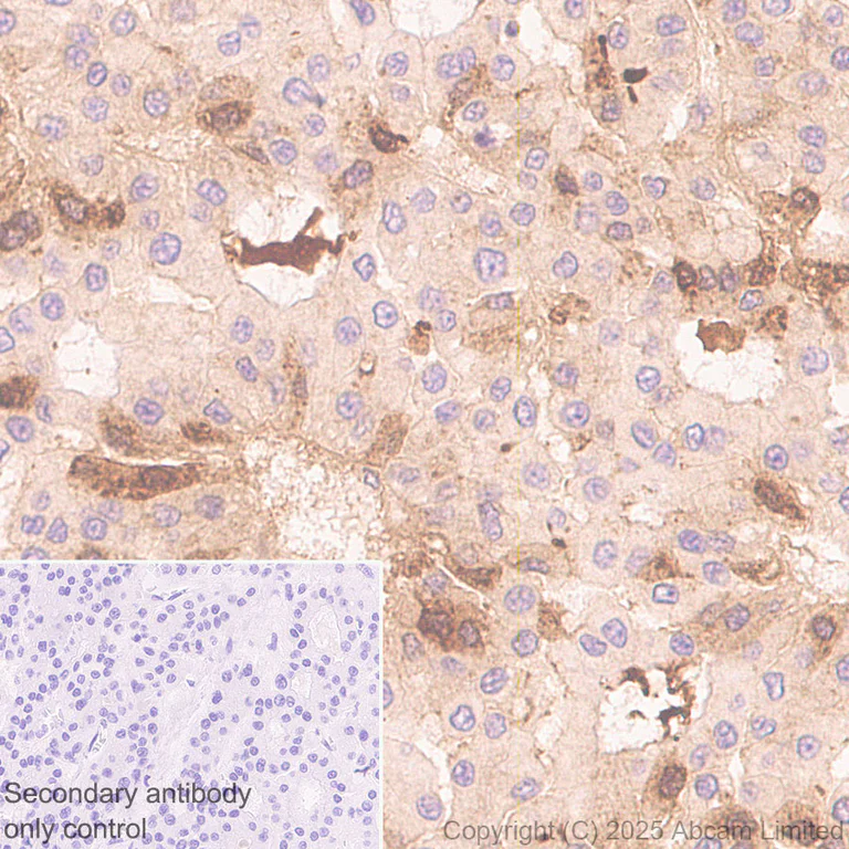 Immunohistochemistry (Formalin/PFA-fixed paraffin-embedded sections) - Anti-Angiogenin antibody [RM2092] (AB325241)