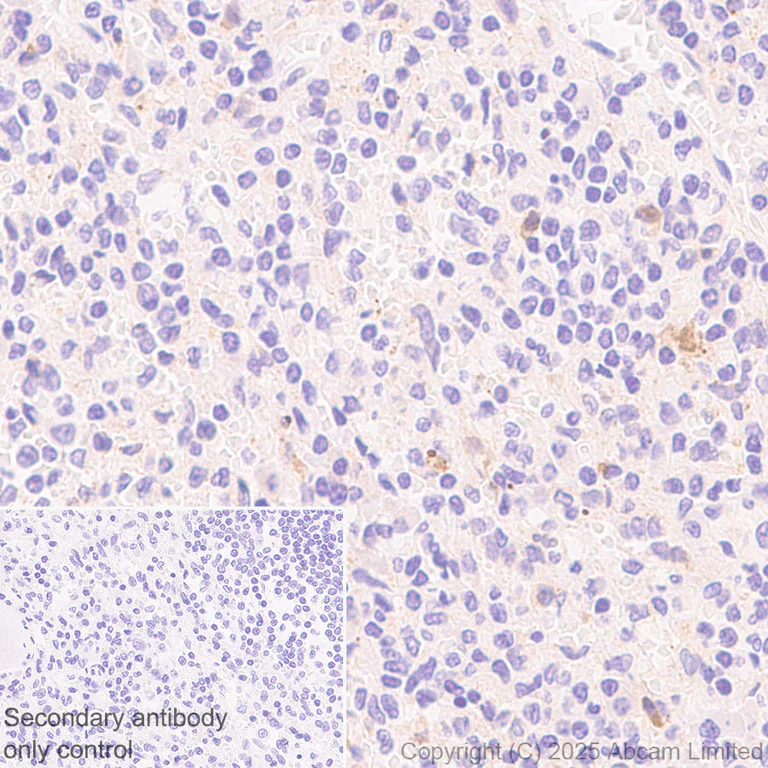 Immunohistochemistry (Formalin/PFA-fixed paraffin-embedded sections) - Anti-Angiogenin antibody [RM2092] (AB325241)