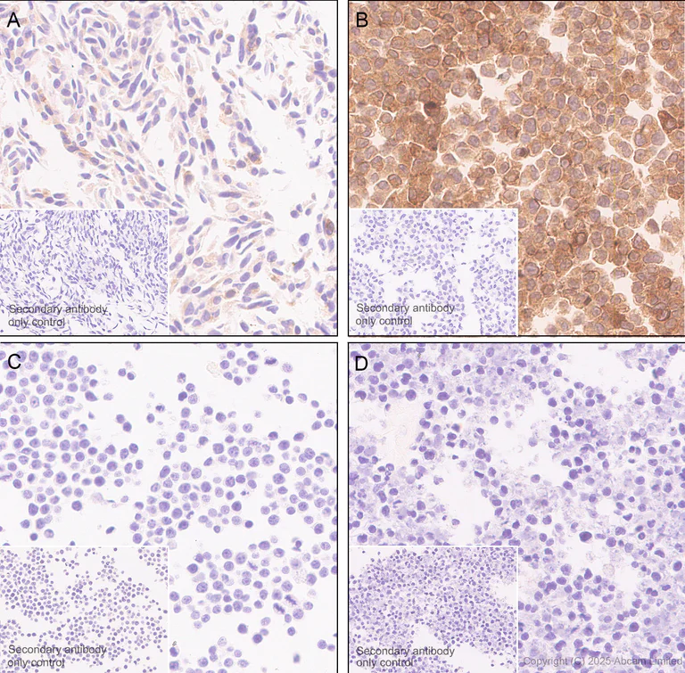 Immunohistochemistry (Formalin/PFA-fixed paraffin-embedded sections) - Anti-Angiogenin antibody [RM2092] (AB325241)