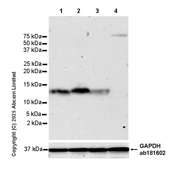 Western blot - Anti-Angiogenin antibody [RM2092] (AB325241)