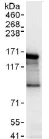 Immunoprecipitation - Anti-Angiomotin antibody (AB117776)