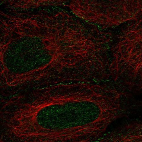 Immunocytochemistry/ Immunofluorescence - Anti-Angiomotin antibody (AB244534)