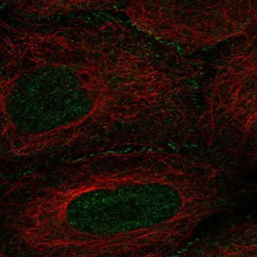 Immunocytochemistry/ Immunofluorescence - Anti-Angiomotin antibody (AB244534)