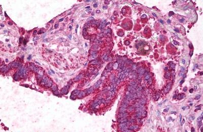 Immunohistochemistry (Formalin/PFA-fixed paraffin-embedded sections) - Anti-Angiopoietin 1 antibody (AB133425)