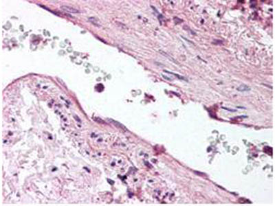 Immunohistochemistry (Formalin/PFA-fixed paraffin-embedded sections) - Anti-Angiopoietin 1 antibody (AB8451), expandable thumbnail