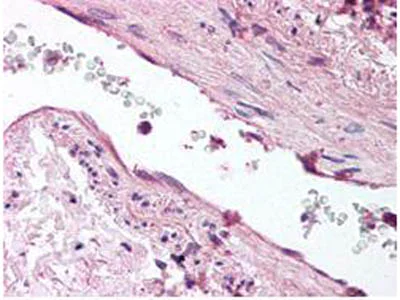 Immunohistochemistry (Formalin/PFA-fixed paraffin-embedded sections) - Anti-Angiopoietin 1 antibody (AB8451)