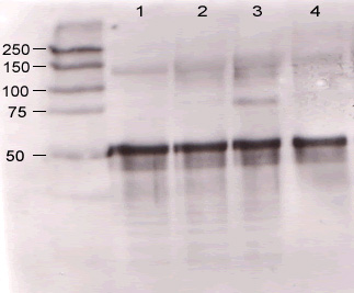 Western blot - Anti-Angiopoietin 1 antibody (AB8451), expandable thumbnail
