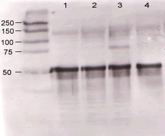 Western blot - Anti-Angiopoietin 1 antibody (AB8451)