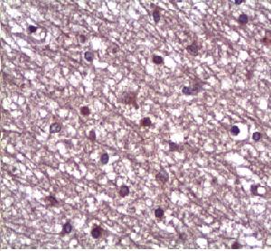Immunohistochemistry (Formalin/PFA-fixed paraffin-embedded sections) - Anti-Angiopoietin 1 antibody (AB94684)