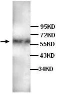 Western blot - Anti-Angiopoietin 1 antibody (AB94684)