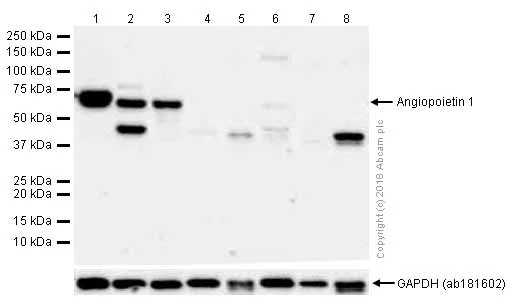 Western blot - Anti-Angiopoietin 1 antibody [EPR2888(N)] - BSA and Azide free (AB250679)
