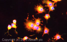 Immunocytochemistry/ Immunofluorescence - Anti-Angiopoietin 2/ANG2 antibody (AB8452)