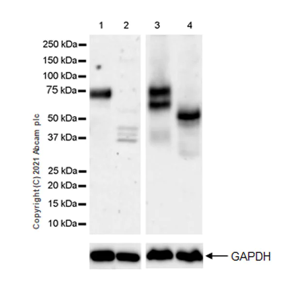 Western blot - Anti-Angiopoietin 2/ANG2 antibody [EPR24161-73] - BSA and Azide free (AB285368)