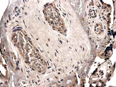 Immunohistochemistry (Formalin/PFA-fixed paraffin-embedded sections) - Anti-Angiopoietin 2/ANG2 antibody [MM0020-1F29] (AB56301)