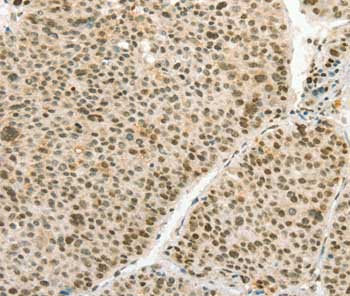 Immunohistochemistry (Formalin/PFA-fixed paraffin-embedded sections) - Anti-Angiopoietin 4 antibody (AB199106)