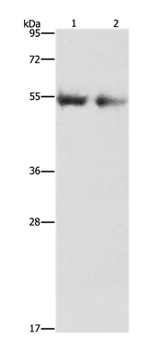 Western blot - Anti-Angiopoietin 4 antibody (AB199106)