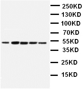 Western blot - Anti-Angiopoietin-like 4/ANGPTL4 antibody (AB115798), expandable thumbnail