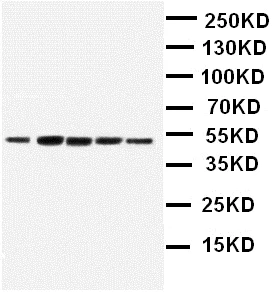 Western blot - Anti-Angiopoietin-like 4/ANGPTL4 antibody (AB115798)