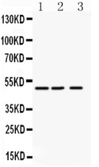 Western blot - Anti-Angiopoietin-like 4/ANGPTL4 antibody (AB115798), expandable thumbnail