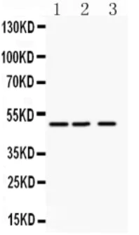 Western blot - Anti-Angiopoietin-like 4/ANGPTL4 antibody (AB115798)