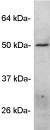 Western blot - Anti-Angiopoietin-like 4/ANGPTL4 antibody (AB2920)