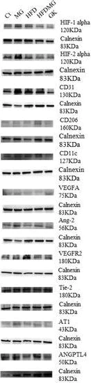 Western blot - Anti-Angiopoietin-like 4/ANGPTL4 antibody (AB2920)