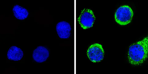 Immunocytochemistry/ Immunofluorescence - Anti-Angiostatin antibody (AB2904)