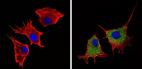 Immunocytochemistry/ Immunofluorescence - Anti-Angiostatin antibody (AB2904)
