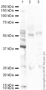 Western blot - Anti-Angiostatin antibody (AB2904)